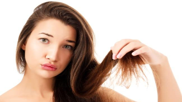 Berbagai Masalah Rambut yang Sering Kali Dialami Banyak Orang